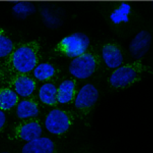 Glycobiology and Glycomics